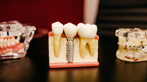 Clinica Dental Alvarez logo