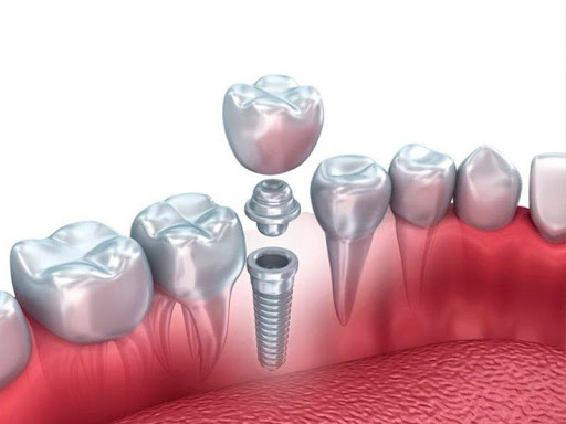 Clinica Dental Family