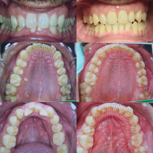 Clinica Dental Ikaldental