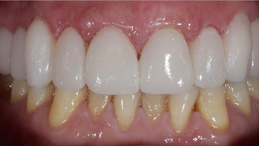 Clinica Dental Dentalex